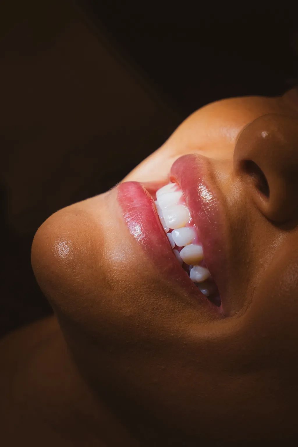 Gros plan d’un sourire aux dents blanches et naturelles après un traitement esthétique