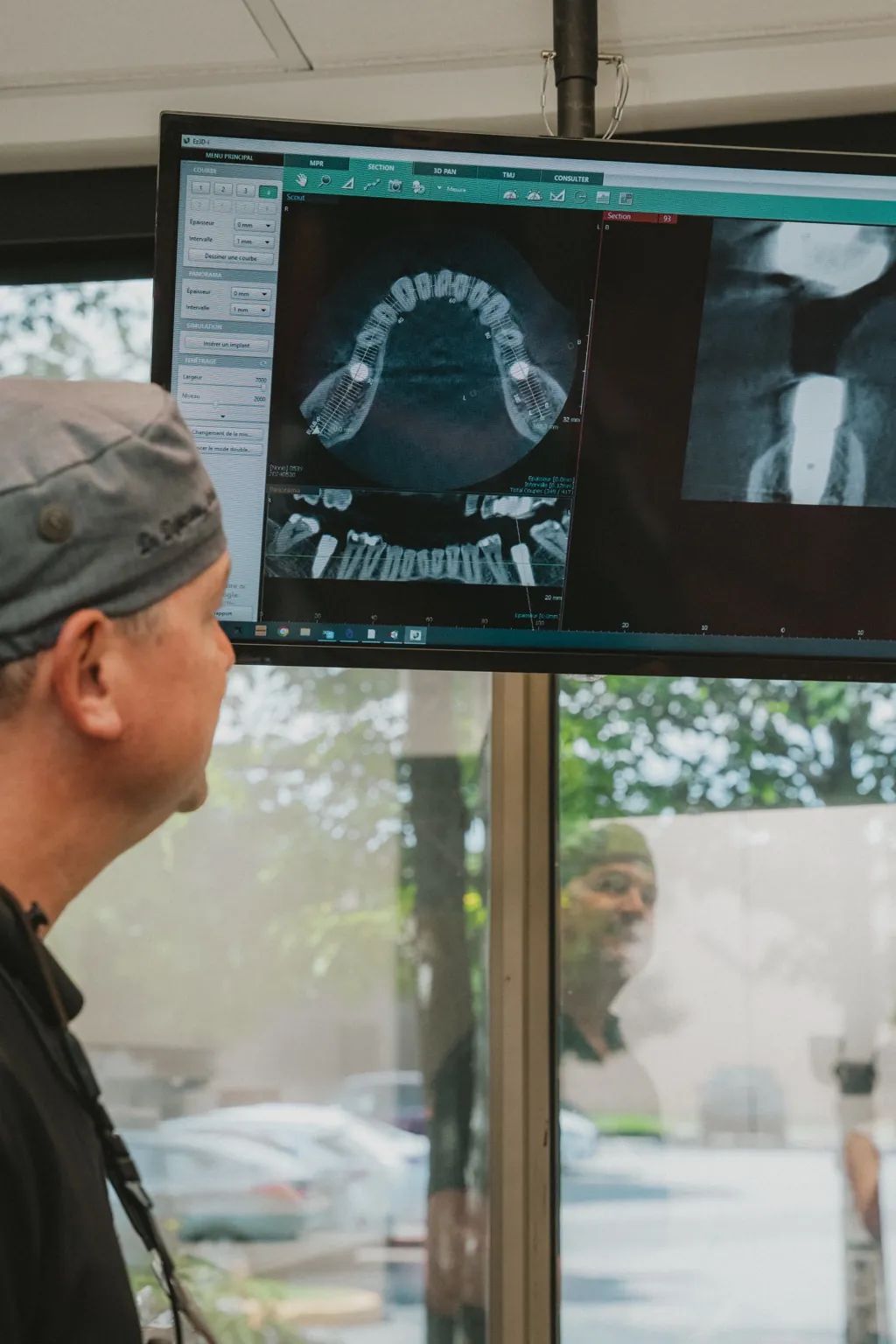 Dentiste analysant une imagerie 3D des dents sur un écran de diagnostic