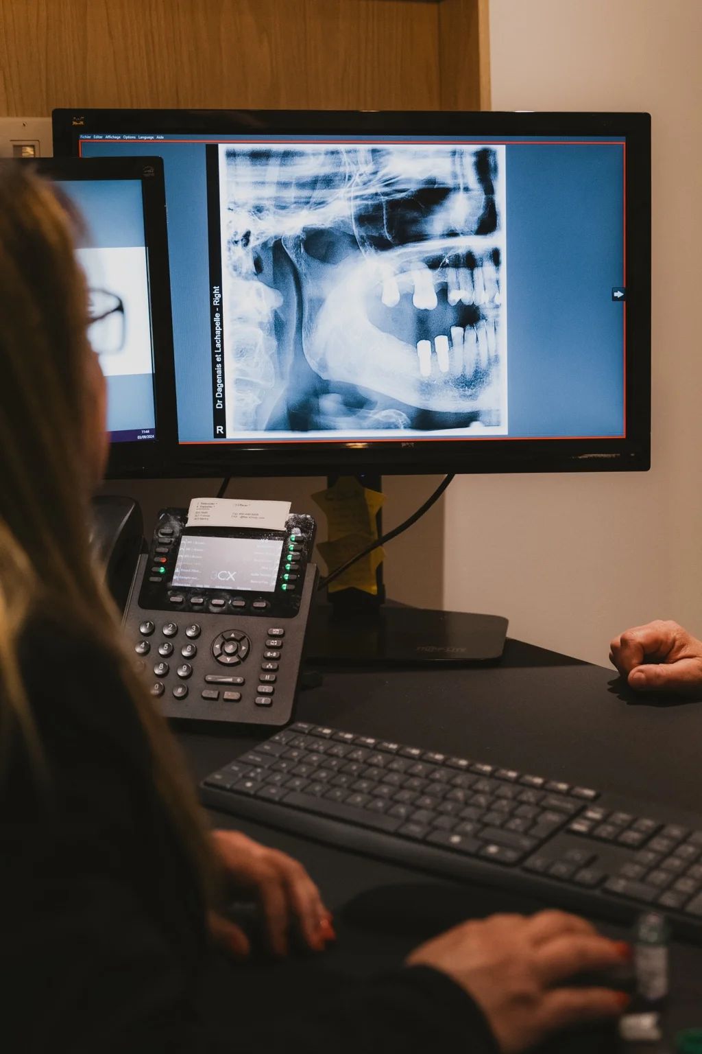 Analyse d’une radiographie dentaire affichée sur un écran lors d’une consultation.